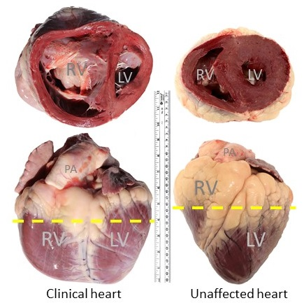Clinical versus unaffected BCHF hearts
